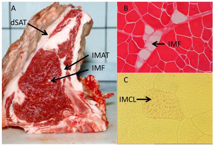 Molecular Heterogeneities of Adipose Depots - Potential Effects on